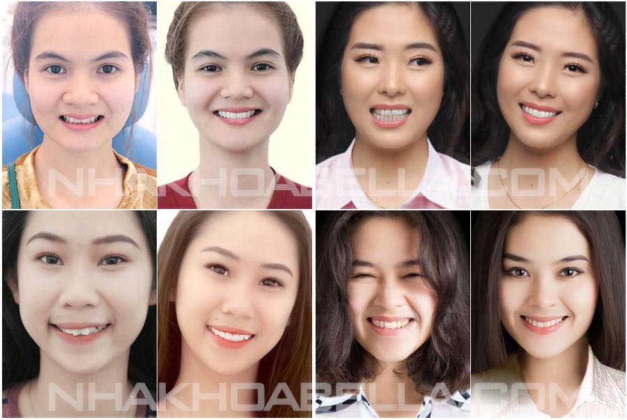 Nha khoa uy tín tphcm tiếp nhận hơn 10000 ca mỗi năm