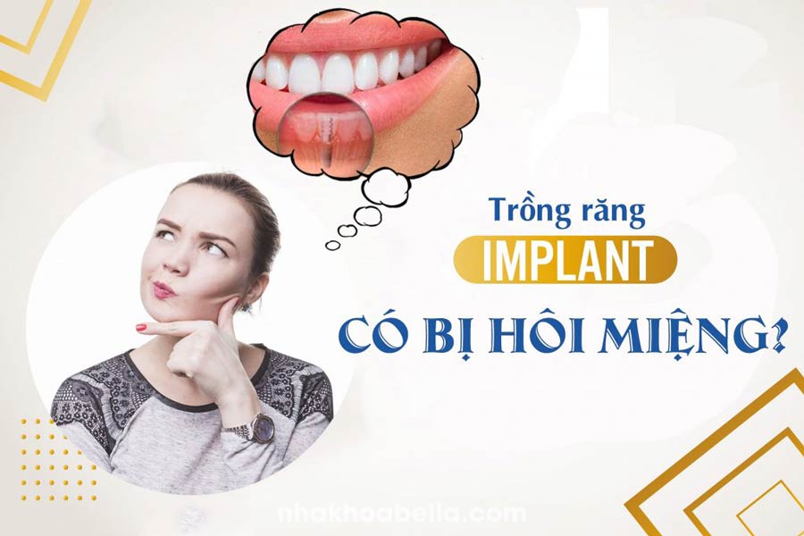 Trồng răng implant có bị hôi miệng không, bác sĩ CKI giải đáp