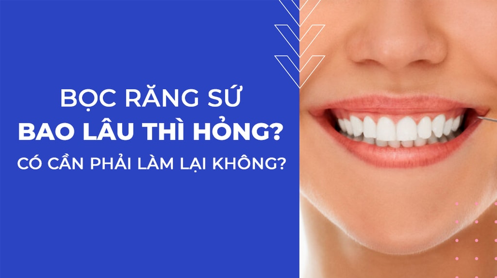 Bọc răng sứ bao lâu thì hỏng? Có cần phải thay lại không?