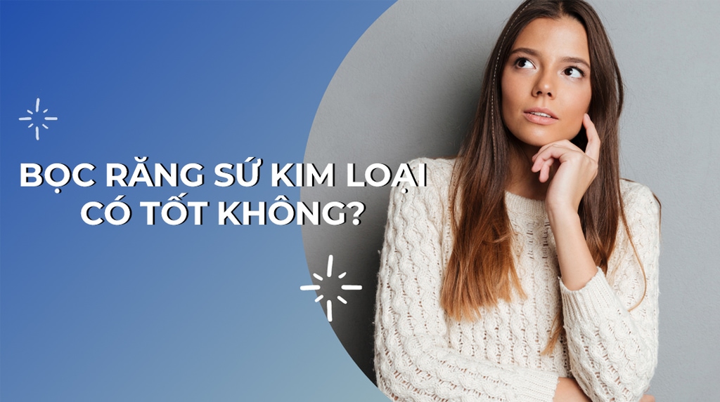 Bọc Răng Sứ Kim Loại Có Tốt Không