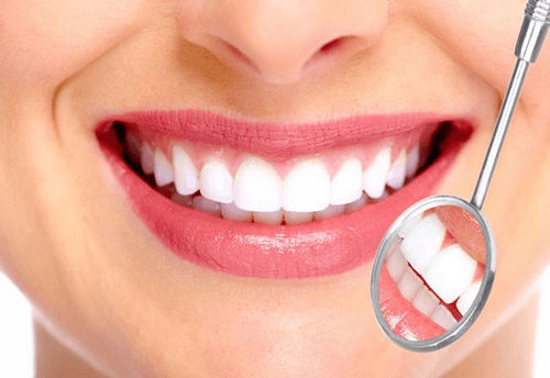 Bọc răng sứ bao lâu thì hỏng?
