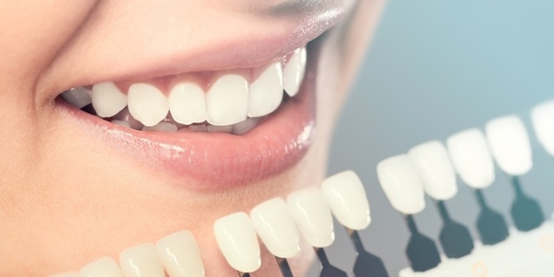 Sau khi thực hiện bọc răng sứ cho răng hô bạn cần chú ý tái khám định kỳ để theo dõi kỹ lưỡng