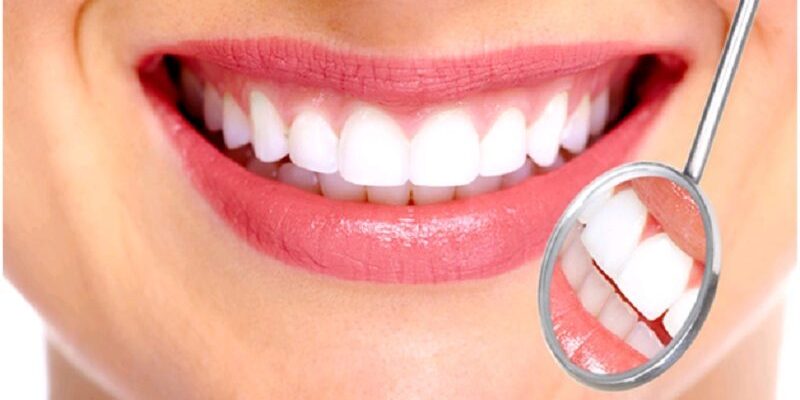 Việc khắc phục răng bị lệch, mọc lộn xộn rất được các bác sĩ khuyến khích để bảo vệ sức khỏe răng miệng của bạn