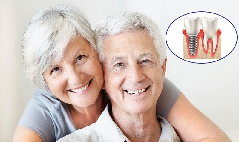 Có nên trồng răng Implant cho người già hay không?