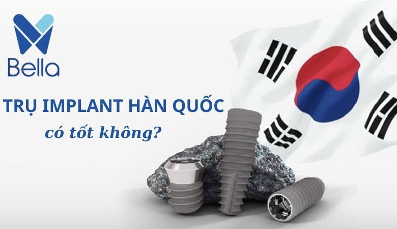 trồng răng implant hàn quốc có tốt không