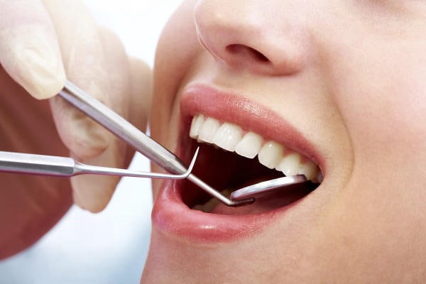Thắc mắc tẩy trắng răng duy trì được bao lâu?