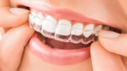 Niềng răng trong suốt Invisalign vì sao lại được nhiều người lựa chọn?