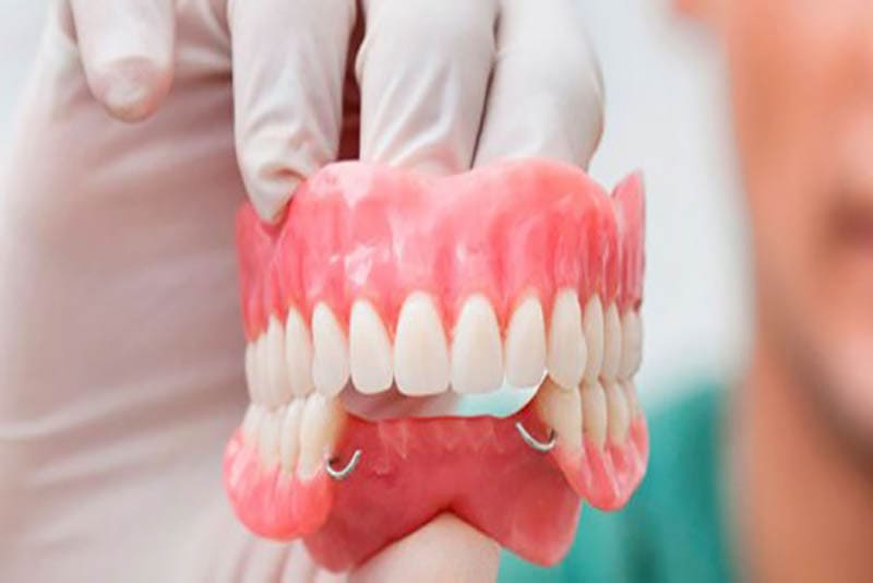 Thực hiện quy trình làm răng tháo lắp qua 2 lần tái khám