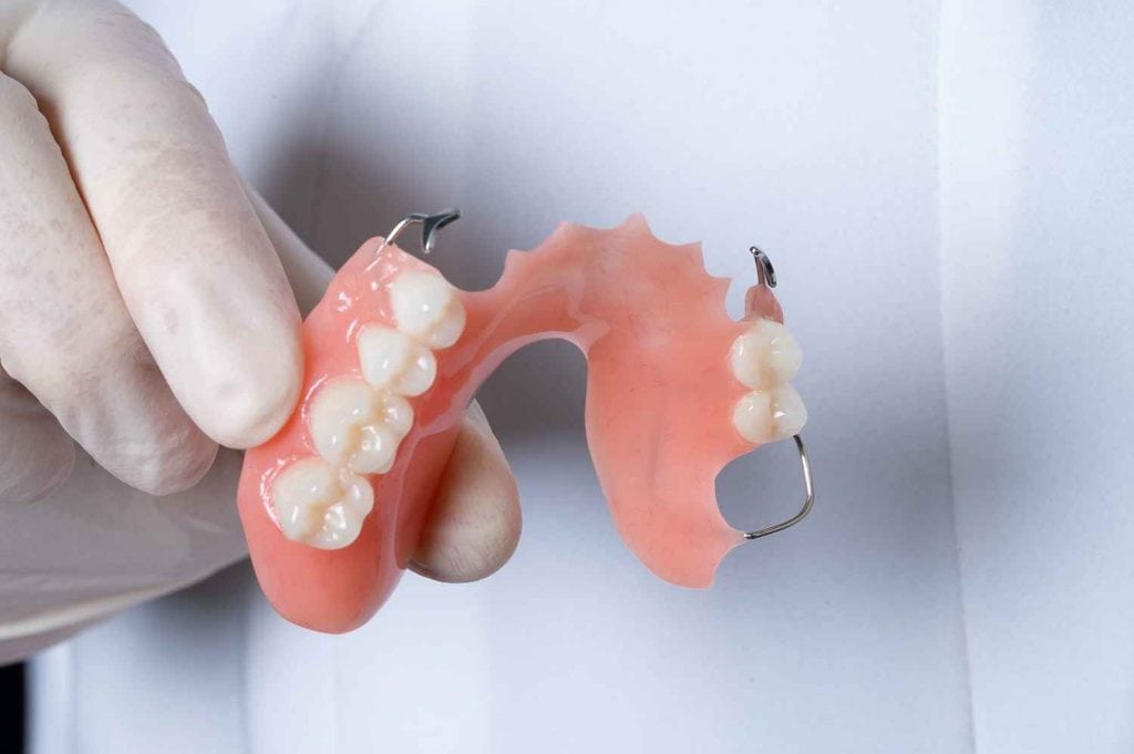 Răng giả tháo lắp chất liệu kim loại