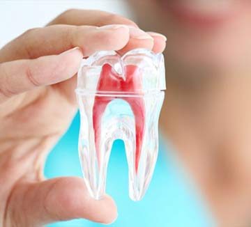 Tăng độ bền răng sau chữa tủy