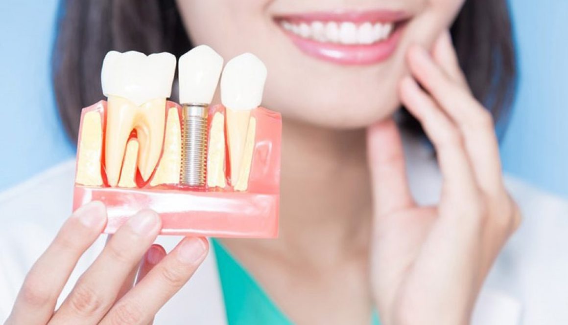 Trồng răng implant có đau không? Cách giảm đau hiệu quả