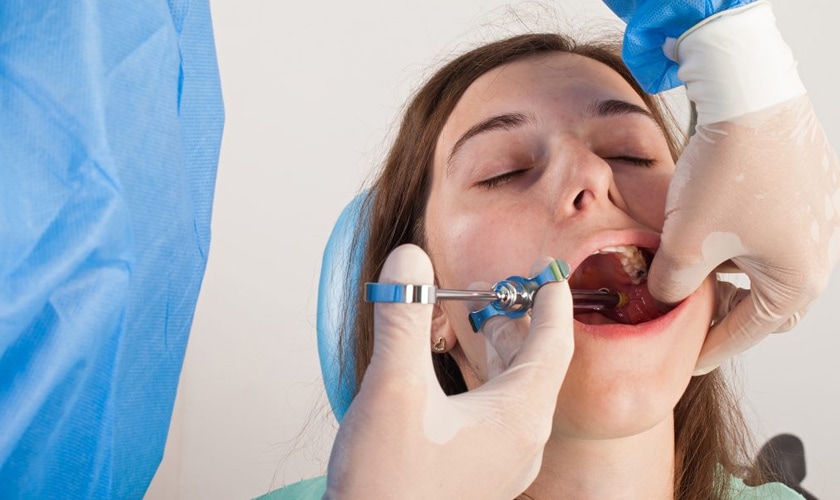 Vị trí cấy ghép sẽ quyết định trồng răng implant có đau không?