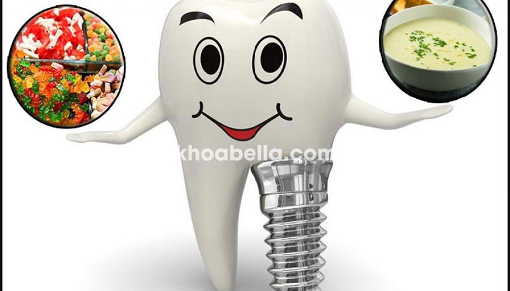 Sau trồng răng implant kiêng ăn gì