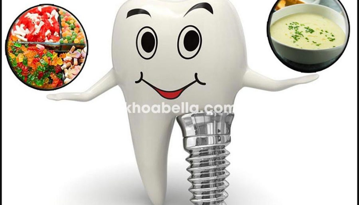 Sau trồng răng implant kiêng ăn gì