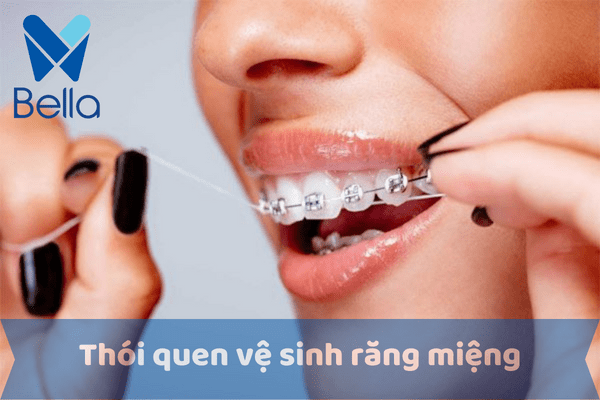 Chăm sóc răng miệng kỹ hơn khi niềng răng mắc cài vào mùa hè