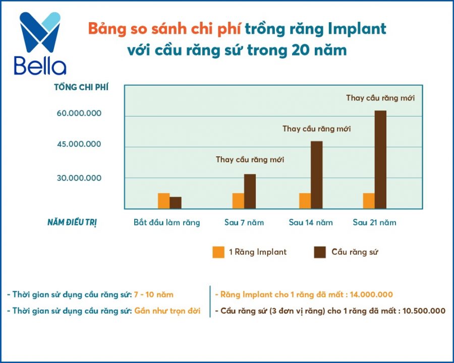 So sánh chi phí Cấy Ghép Implant và Bắc Cầu răng sứ