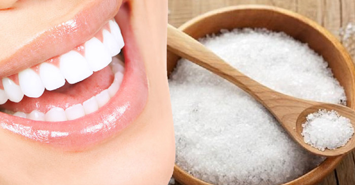 Tẩy răng trắng tại nhà bằng muối