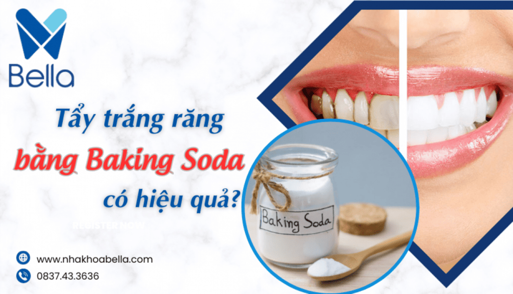 tẩy trắng răng bằng Baking Soda