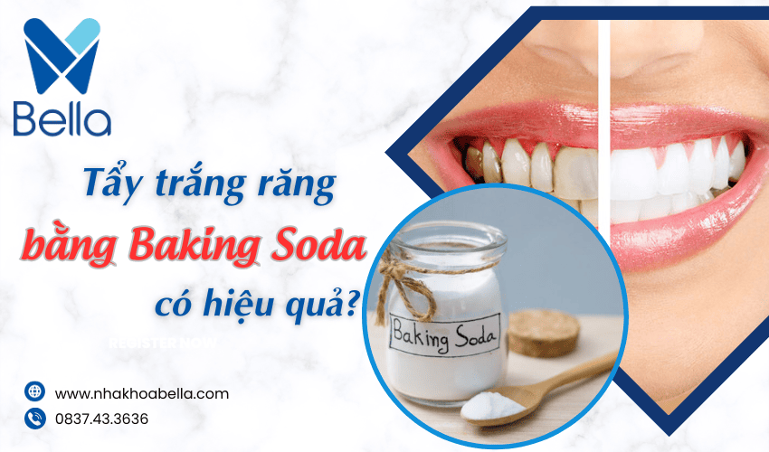 tẩy trắng răng bằng Baking Soda