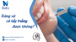 Thắc mắc: Răng sứ có tẩy trắng được không? Răng sứ có tẩy trắng được không (1)