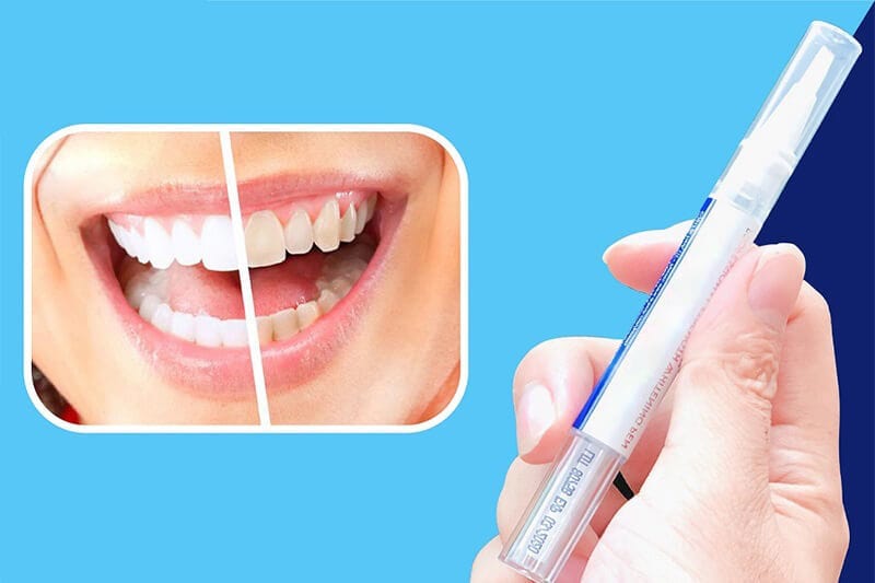 Bút tẩy trắng răng có thực sự đem lại hiệu quả?