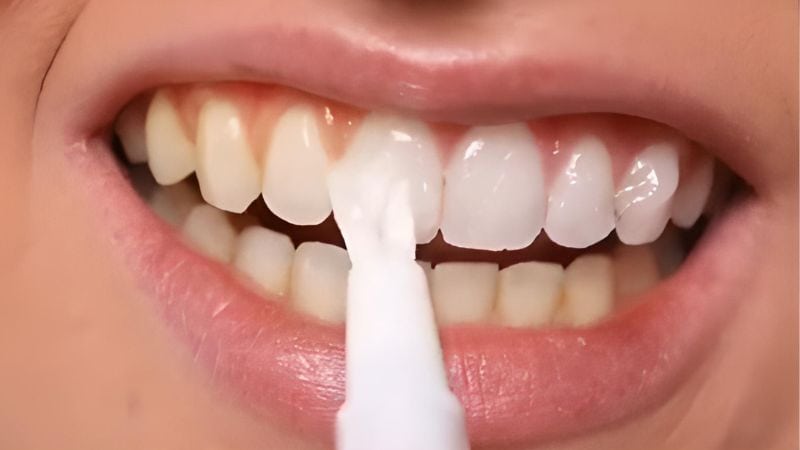 Cách sử dụng bút tẩy trắng răng