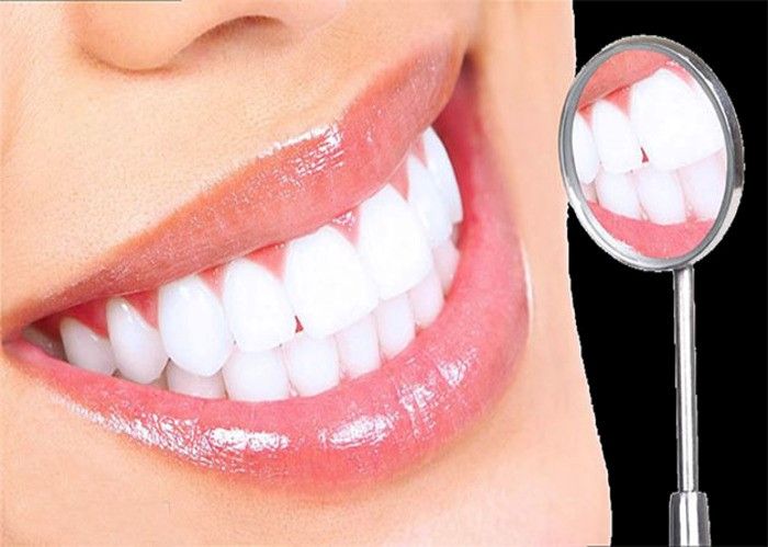 Bọc răng sứ có tẩy trắng được không, cách làm trắng răng sứ